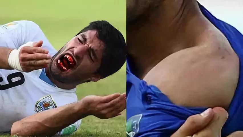 世界杯 咬人,世界杯咬人事件 世界杯 咬人,世界杯咬人事件